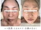 パーム(Perm)の写真