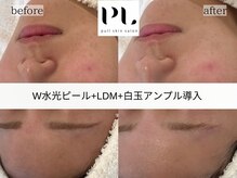 プルスキンサロン 大阪店(pull skin salon)/