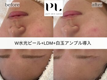 プルスキンサロン 大阪店(pull skin salon)/