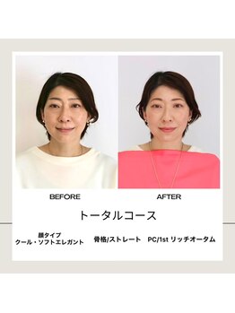 シュアリー(Surely)/トータルコースお客様事例