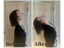 整体ラルース 中目黒(LALUZ)/50代 女性 ストレートネック改善