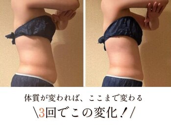 ヨサパーク ハット(YOSA PARK HAT)