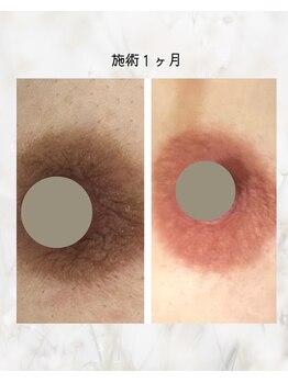 カルミア(kalmia)/ルメラ