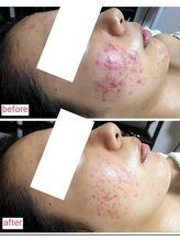 ミュー(Mieux)/通い始めて一気に良くなった