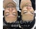 クラン(CLAN)の写真