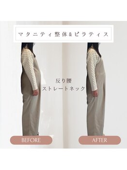 心斎橋長堀フェムテック整骨院の写真/【マタニティ整体＆ピラティス】妊娠中の腰痛や産後の体型戻しに！体幹が強化され一生モノの美姿勢に★