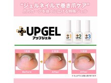 トイロネイル(toironail)/巻き爪ケア