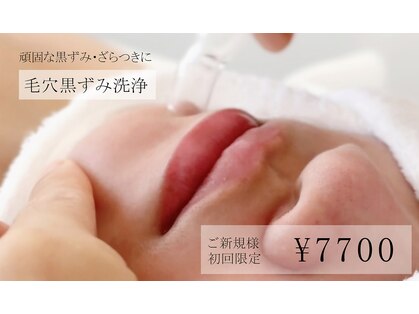 inizia eliteの写真