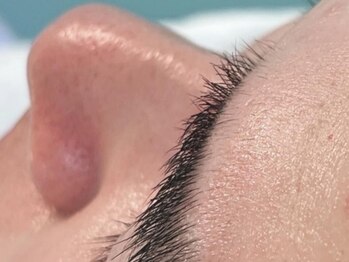 ジェリー(JERRY)の写真/イチゴ鼻、黒ずみ毛穴、白い角栓詰りに！[毛穴エクストラクション]でごっそり毛穴洗浄！育毛促進MENUも有◎