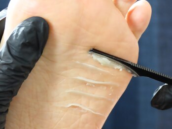 WRネイルズ(WR Nails)の写真/【韓国式足裏角質除去】最先端フットケアでツルふわ綺麗な足裏に♪かかとのガサつきでお悩みの方にも◎