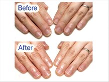 マニネイルケア 府中店(maninail CARE)/ビフォーアフター
