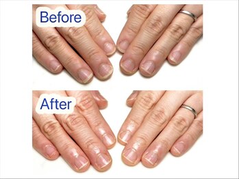 マニネイルケア 府中店(maninail CARE)/ビフォーアフター