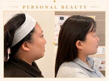 PB/レモンボトル