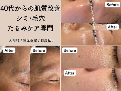 ミーツ(Meets)の写真
