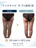 【最近また気になってきた方へ】キャビプロで脂肪・むくみを集中メンテナンス