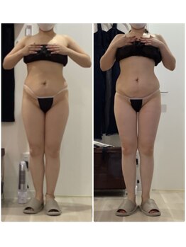 プラチナアース 守谷店(Platinum earth)/くびれ、お腹が得意な守谷店２