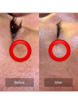 凛と慶/赤丸をみて!