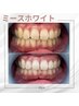★初回限定★美白セルフホワイトニング9分照射¥5,500→¥3,000