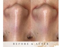 ゼロ アンド リセット(0ZERO&RESET)/【メンズ脱毛】0ZERO&RESET