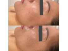 ベル(belle)の雰囲気（それぞれのお悩みに合わせた施術をしっかりとご提案致します♪）