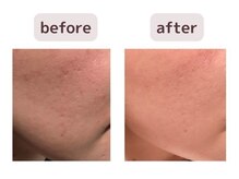 リジェネラティブセル メディカルサロン(Regenerative Cell Medical Salon)/ビフォーアフター