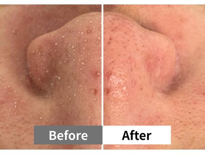 アーキ(ARCHI)の写真