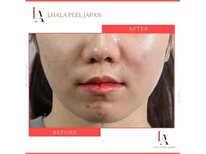 ナル ゆあん鍼灸接骨院(nalu)の写真