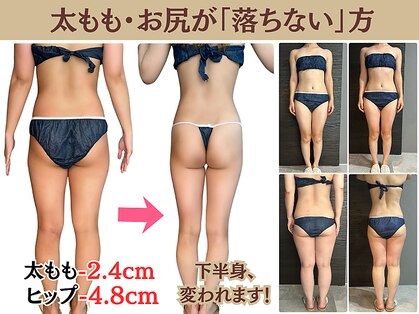 ヘッテ(Hette)の写真