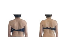 メリア(Mellia)/ブライダルエステ