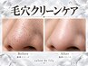 黒ずみ撃退!【!!全顔!!】毛穴クリーンケア単品メニュー※モニター価格