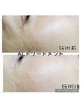 ハナ(HANA)/金賞受賞エステ