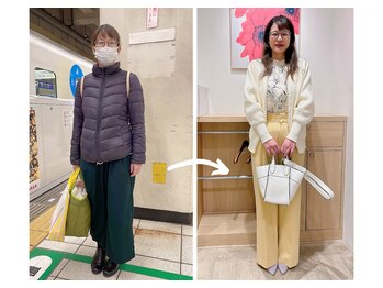 エピファニー 東京 銀座/ビフォーアフター(Y.H様)