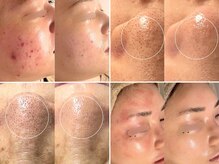 マイナプラ 表参道(myna+)/