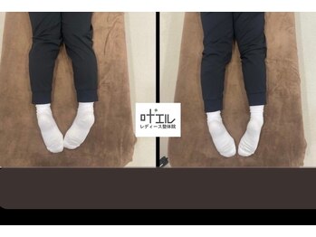 叶'エル 本町 心斎橋院/姿勢改善　骨盤矯正