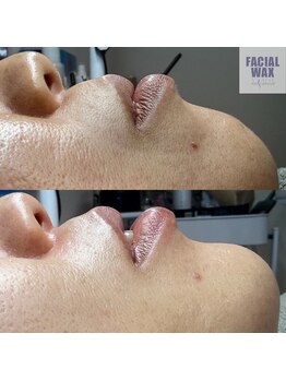 アレーズファイブフォー(A’LAISE54)/フェイシャルワックス