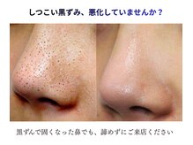 シャルトルズ 西宮北口店の雰囲気（終わりのあるケアをご提案。専門のスタッフにお任せください）