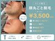 ミミロンビューティー(Mimiron Beauty)の写真/【井尻駅より徒歩1分】初めての方でも安心して通える脱毛サロン☆都度払い・サブスク有/全身脱毛/VIO/井尻