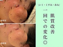 サンラックスサロン 岐阜(SANlux Salon)