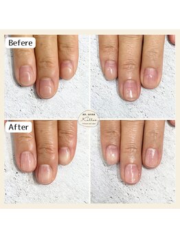 他店様ジェルオフ+ネイルケア