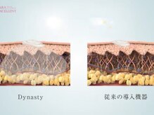 サラエクセレント 梅田(SARA EXCELLENT)/《バストアップ》