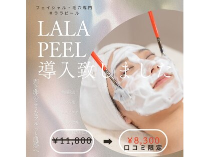 ウイ(u'i)の写真