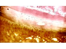 清耳み(shijimi)/毛細血管の観察