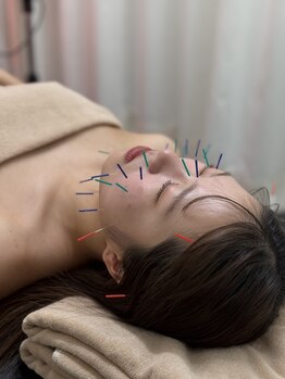 いさはや鍼灸整骨院の写真/《ヘッドマッサージ+美容鍼》当院オリジナルMENU！相乗効果をもたらし貴方の疲れを癒します♪初回限定¥2500