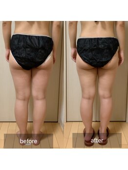 ココカラ(COCOKARA)/インディバ/アロマ　下半身痩せ