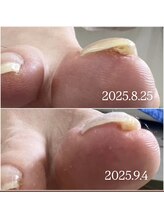 ケア ビューティー ネイル(care beauty NAIL)/