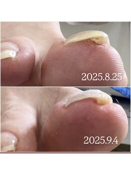 ケア ビューティー ネイル(care beauty NAIL)/