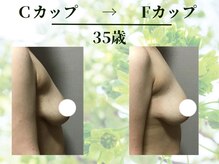 Ms.やまとなでしこ/ビフォーアフター