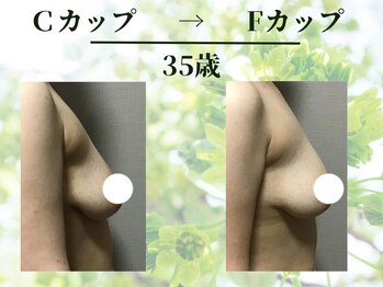 Ms.やまとなでしこ/ビフォーアフター