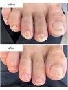 フットネイルケア