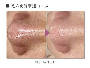 ヴィナチュール(vie nature)/ ■毛穴ケア
